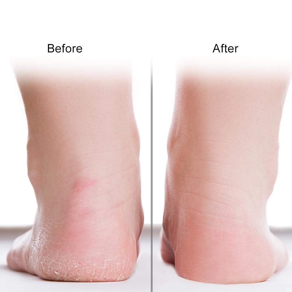 Full-Length Silicone Foot Protector Moisturizing Socks - 1 Pair