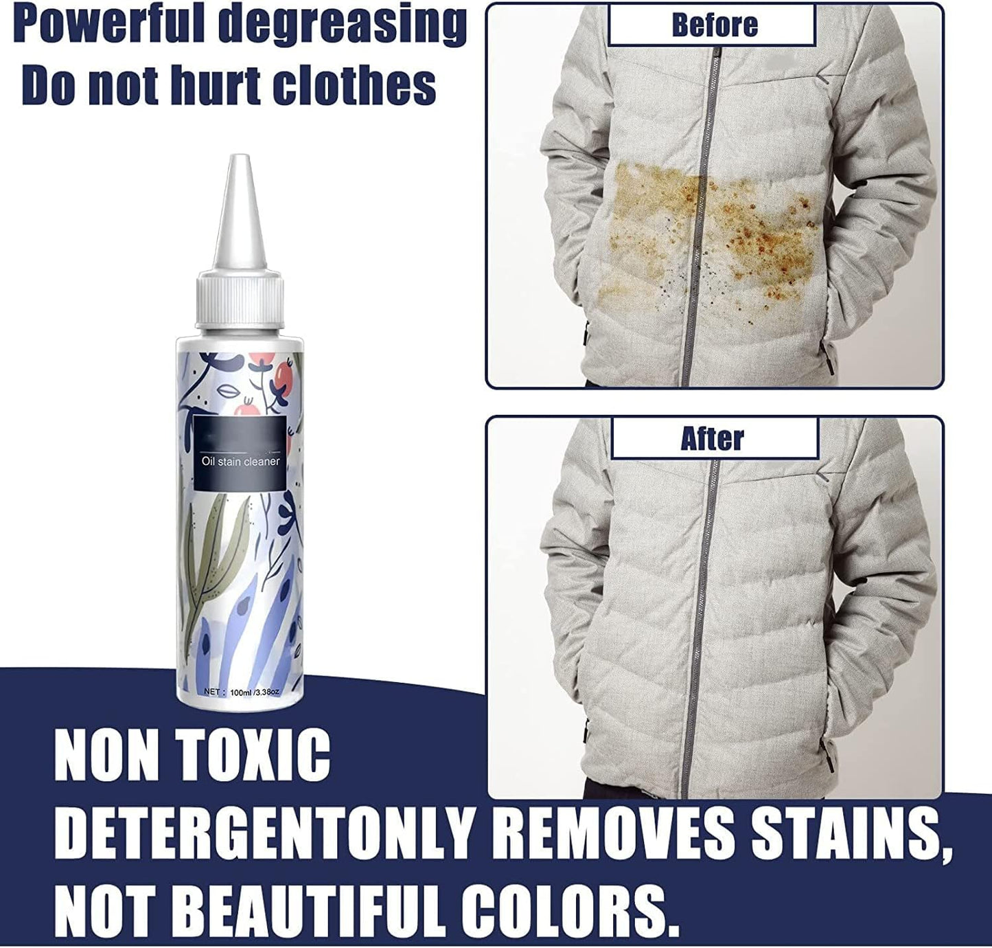 Portable Laundry Stain Remover – Spot Cleaner Pen