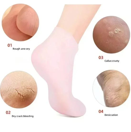 1 Pair Silicone Moisturizing Gel Socks for Cracked Heel Care
