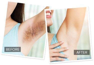 Painless Finishing Touch Yes Hair Remover Machine