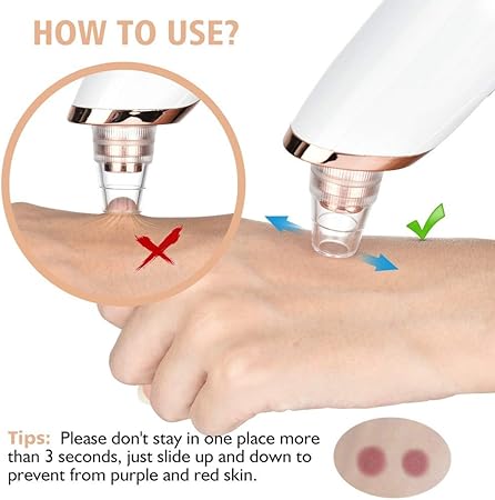 Rechargeable Blackhead Remover Vacuum Pore Cleaner