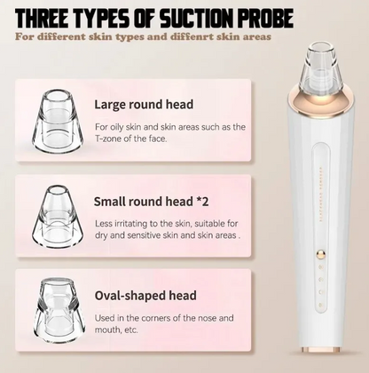 Electric Rechargeable Blackhead Remover Vacuum with 3 Suction Levels